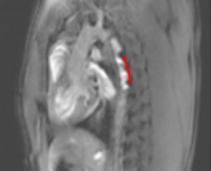 Nano4Imaging – Its depiction in the MRI image